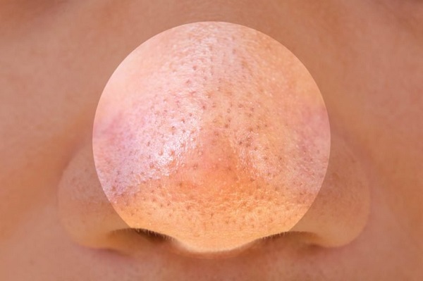 رابطه استرس و شرایط پوست رابطه استرس و شرایط پوست