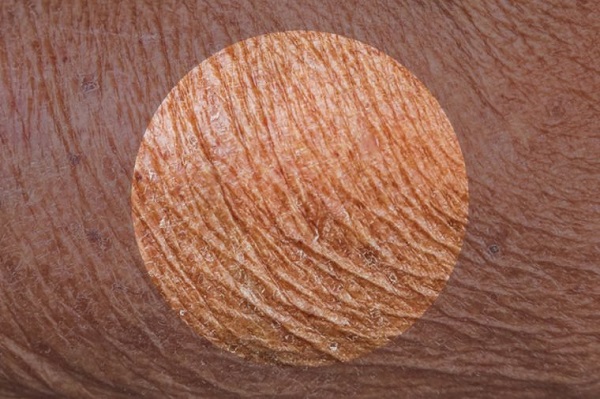 رابطه استرس و شرایط پوست رابطه استرس و شرایط پوست