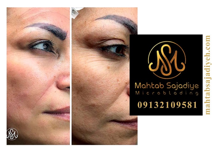 چگونه پوست خود را چندین سال جوان تر کنیم؟ چگونه پوست خود را چندین سال جوان تر کنیم؟