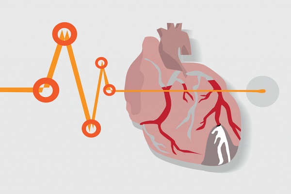 موارد شگفت انگیزی که به سلامت قلب آسیب می زنند موارد شگفت انگیزی که به سلامت قلب آسیب می زنند