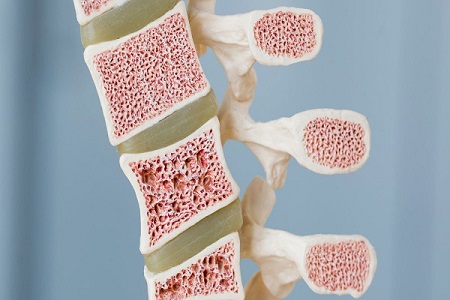 کلینیک سرطان عصر ایران