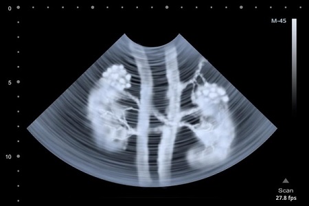 کلینیک سرطان عصر ایران