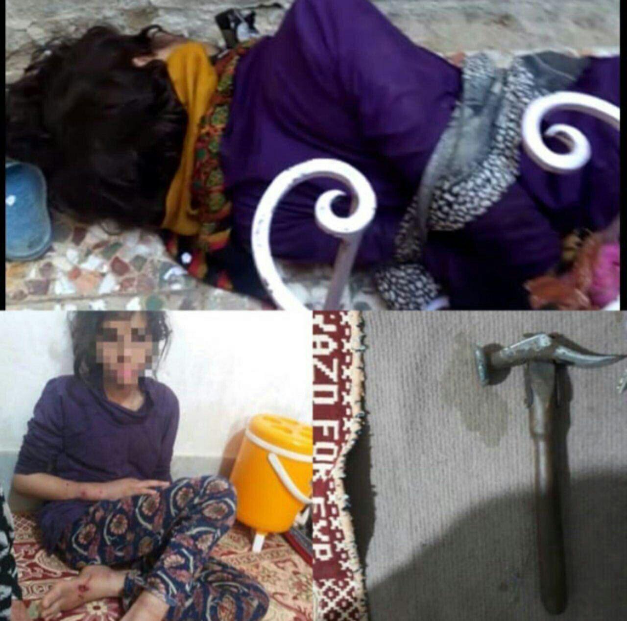 کودکآزاری در بندر ماهشهر/ ضرب و شتم فرزندان با چکش کودکآزاری در بندر ماهشهر/ ضرب و شتم فرزندان با چکش