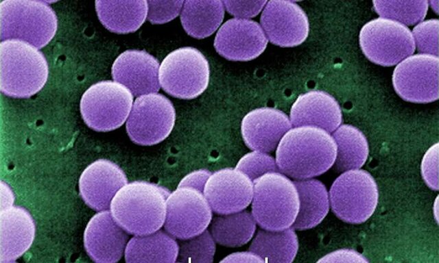 نقش ویتامین D در پیشگیری از ابتلا به عفونت نقش ویتامین D در پیشگیری از ابتلا به عفونت