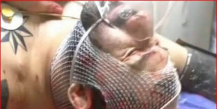 دستگیری یکی از عاملان ضرب و جرح «هانی کُرده»