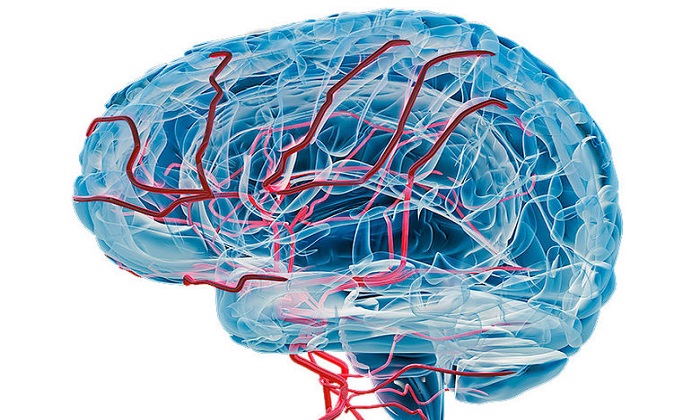 زوال عقل عروقی و دانستنیهایی درباره آن زوال عقل عروقی و دانستنیهایی درباره آن