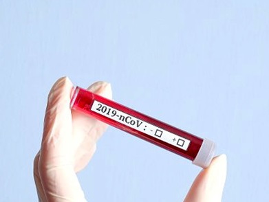 نخستین مورد ابتلا به &laquo;کرونا&raquo; در قطر