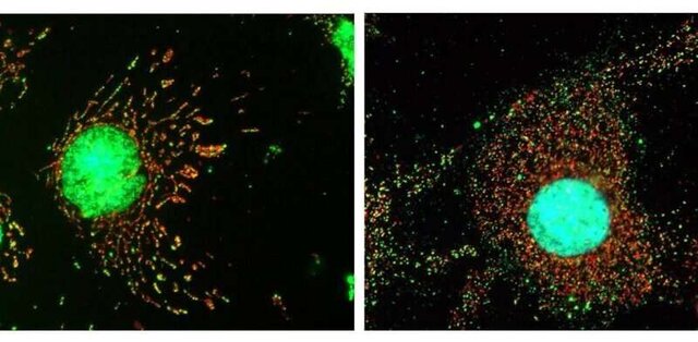 سلولها چگونه از خود در برابر ویروسها دفاع میکنند؟ سلولها چگونه از خود در برابر ویروسها دفاع میکنند؟
