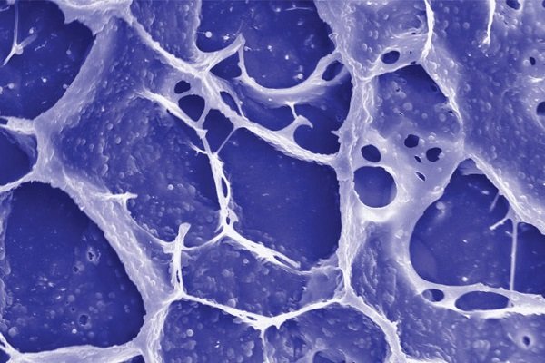 درمان سرطان روده با یک نوع شیمی درمانی جدید از سوی محققان کشور درمان سرطان روده با یک نوع شیمی درمانی جدید از سوی محققان کشور