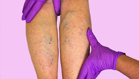 کلینیک قلب عصر ایران/ بروزرسانی اردیبهشت 98