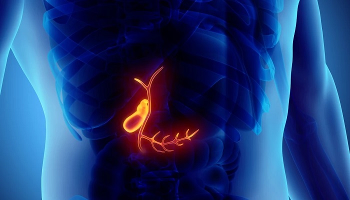 7 نشانه سرطان کیسه صفرا 7 نشانه سرطان کیسه صفرا