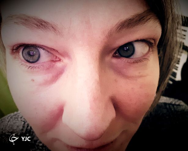 حساسیت به جشن کریسمس