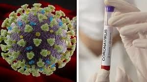 ارسال کیت تشخیص کرونا از ایران به ونزوئلا ارسال کیت تشخیص کرونا از ایران به ونزوئلا