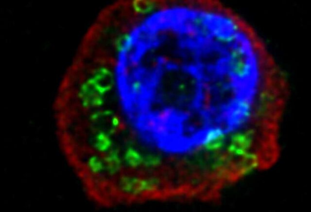 کرمهای انگلی  کرمهای انگلی