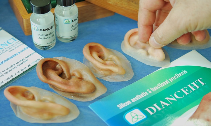 پروتزهایی که زندگی انسان‌ها را تغییر می‌دهند