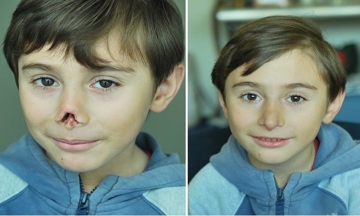 پروتزهایی که زندگی انسان‌ها را تغییر می‌دهند