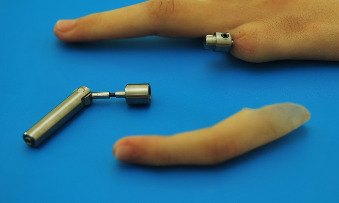پروتزهایی که زندگی انسان‌ها را تغییر می‌دهند