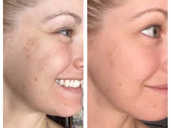 سرم های ویتامین ث، معجزه گران پوست! سرم های ویتامین ث، معجزه گران پوست!