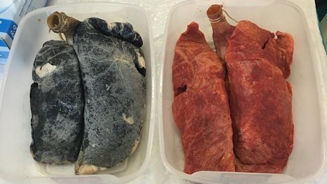 تاثیر سیگار کشیدن بر ریه‌ها به روایت تصویر