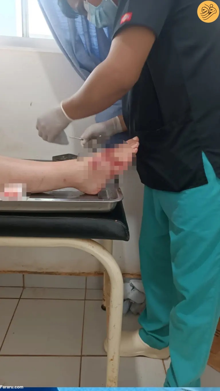 دلفین بخشی از پای زن شناگر را خورد (+عکس)