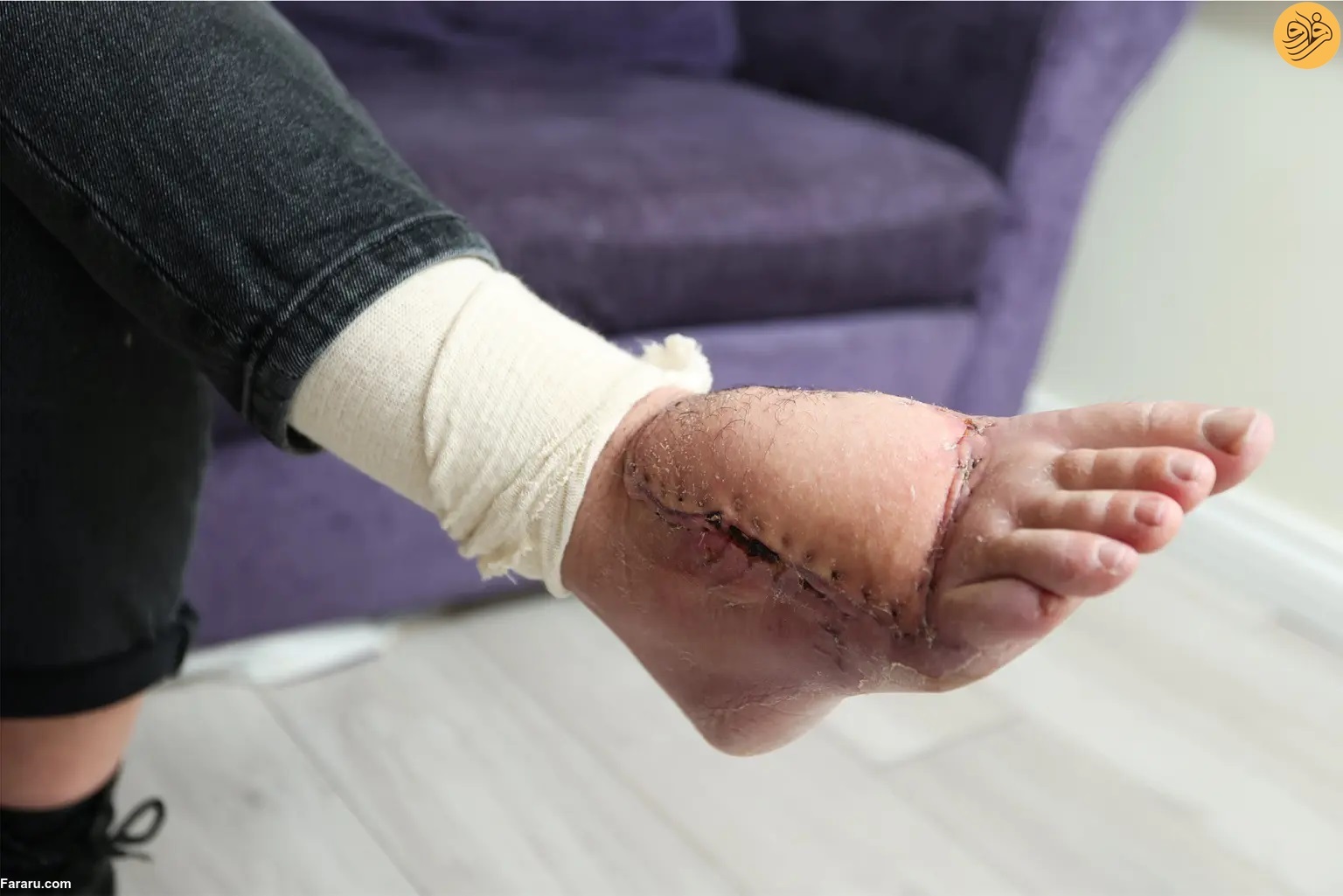 دلفین بخشی از پای زن شناگر را خورد (+عکس)