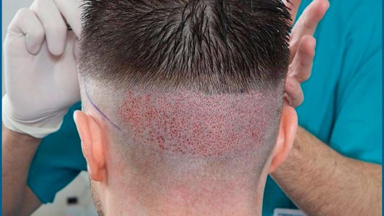 روزنامه شرق: گردشگران از خارج برای جراحی زیبایی به مشهد می آیند/ کار دلال ها سکه است روزنامه شرق: گردشگران از خارج برای جراحی زیبایی به مشهد می آیند/ کار دلال ها سکه است