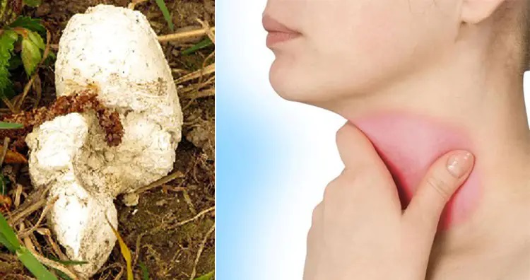 ۱۳ روش درمانی عجیب و غریب در طول تاریخ؛ از خمیر موش تا مربای جنازه