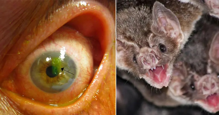 ۱۳ روش درمانی عجیب و غریب در طول تاریخ؛ از خمیر موش تا مربای جنازه