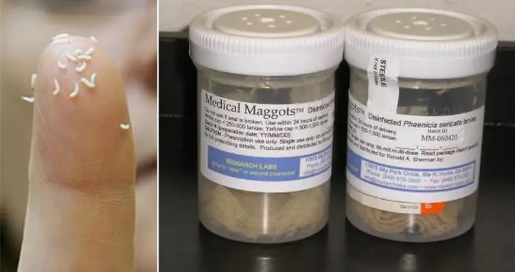 ۱۳ روش درمانی عجیب و غریب در طول تاریخ؛ از خمیر موش تا مربای جنازه