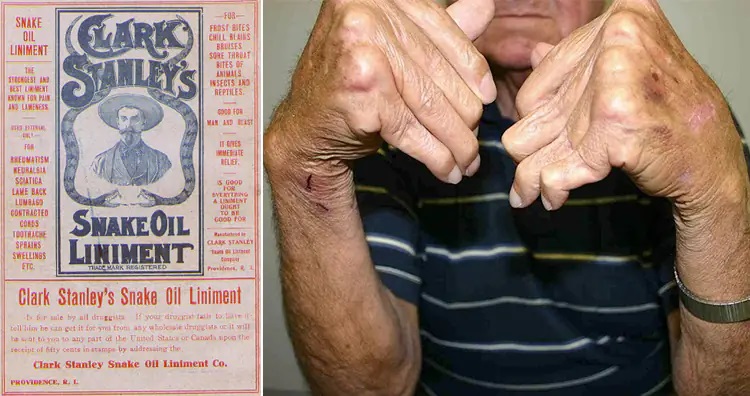 ۱۳ روش درمانی عجیب و غریب در طول تاریخ؛ از خمیر موش تا مربای جنازه