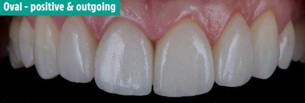 دندان های شما در مورد شخصیت تان چه می گویند؟ دندان های شما در مورد شخصیت تان چه می گویند؟