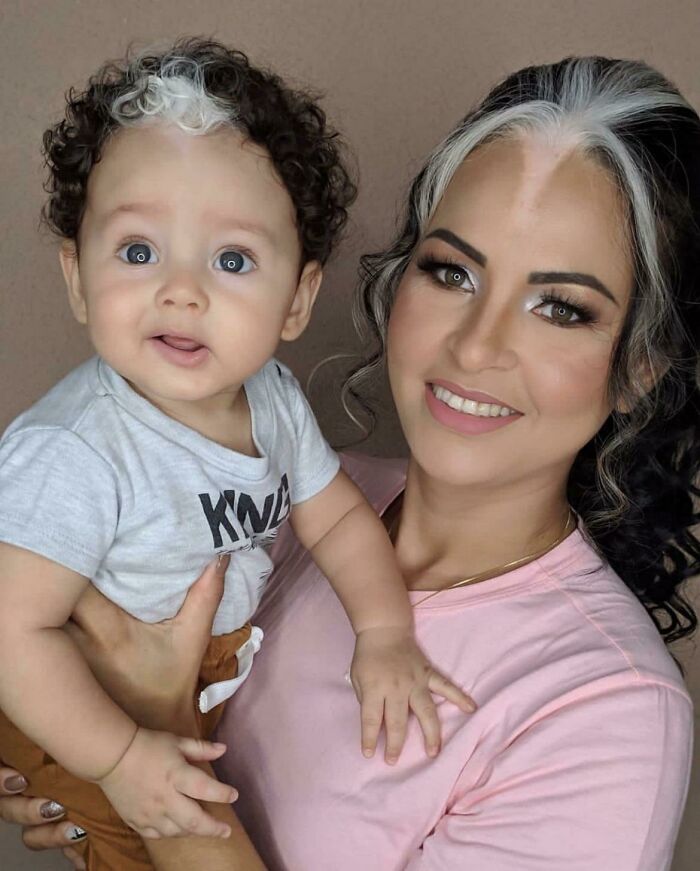 چند تصویر از نادرترین انسان‌های کره زمین