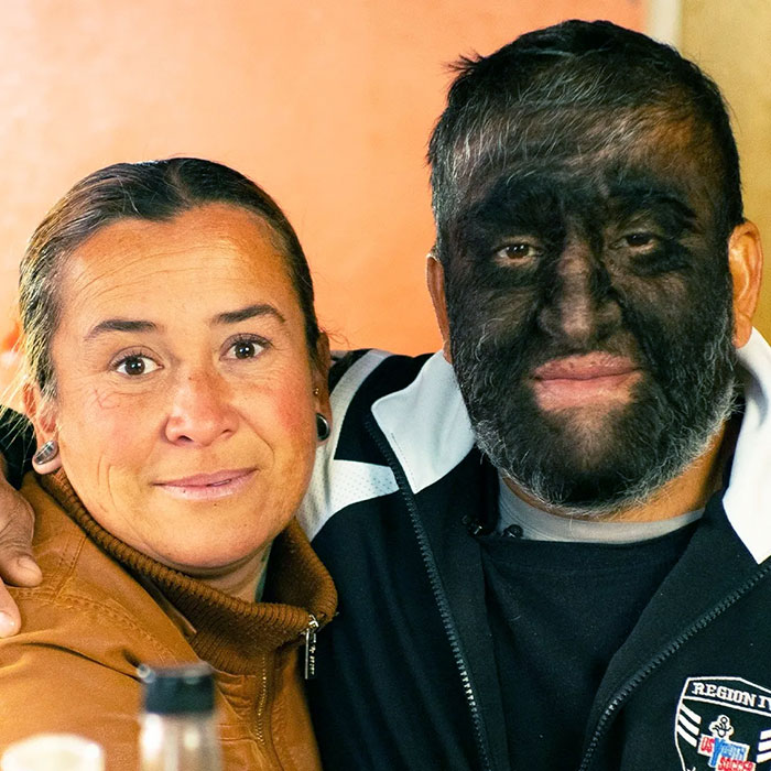 چند تصویر از نادرترین انسان‌های کره زمین