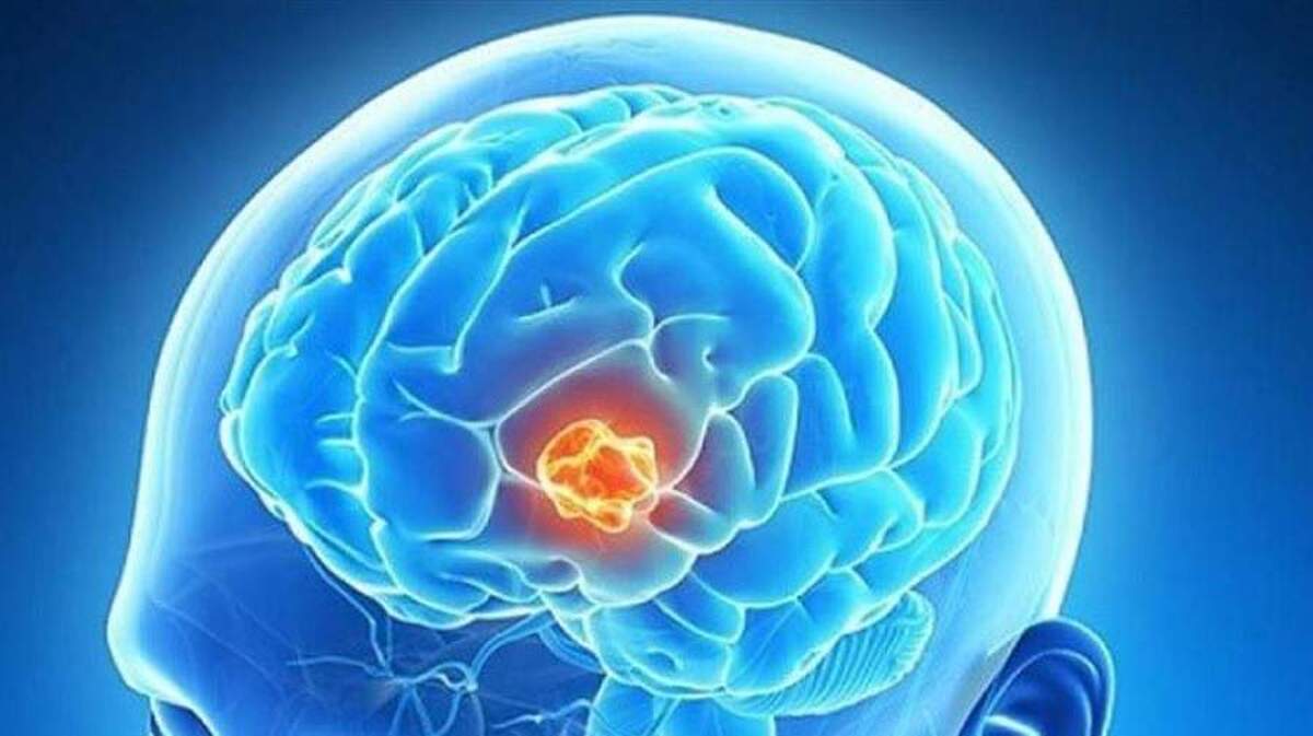 چگونه می توان میزان شدت یک خاطره بد را کاهش داد؟!