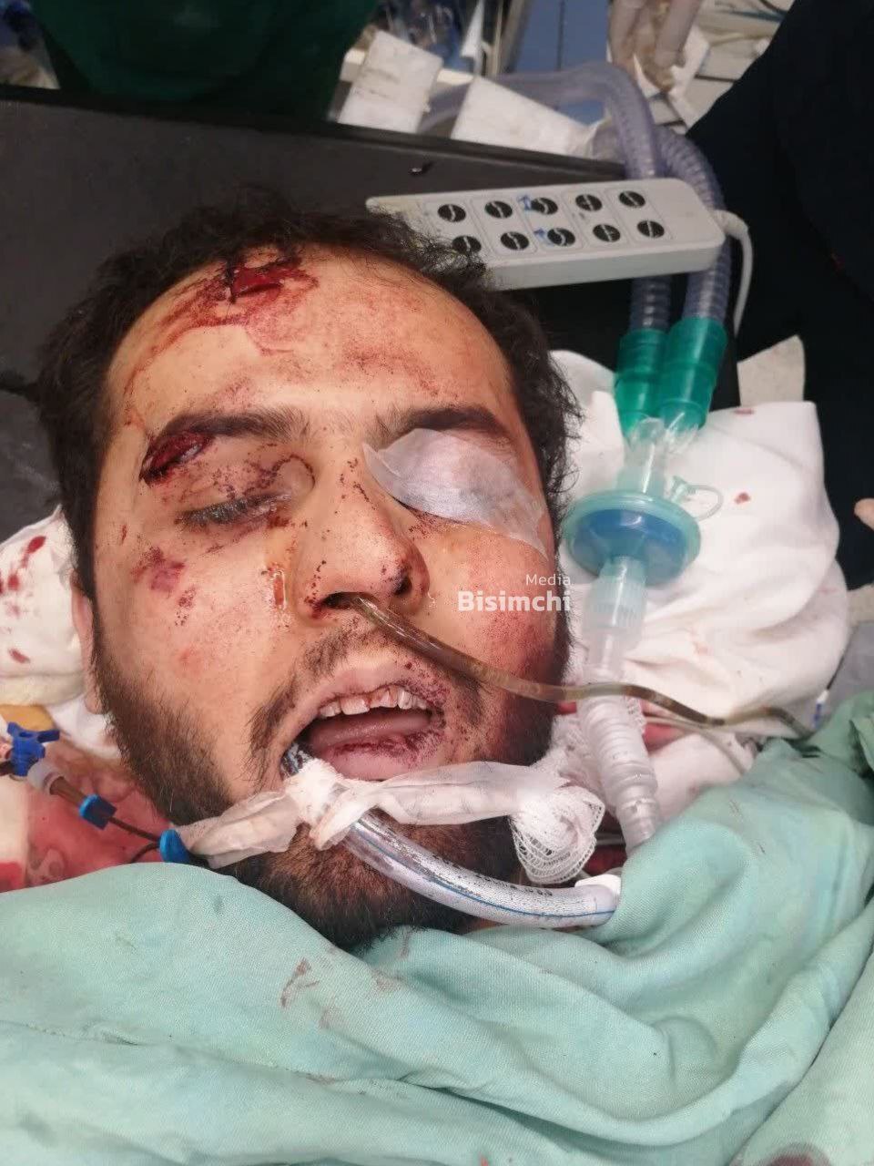 معاون استانداری فارس: عامل تروریستی حمله به حرم شاهچراغ جوانی سی ساله است/ عملیاتش را انفرادی انجام داده