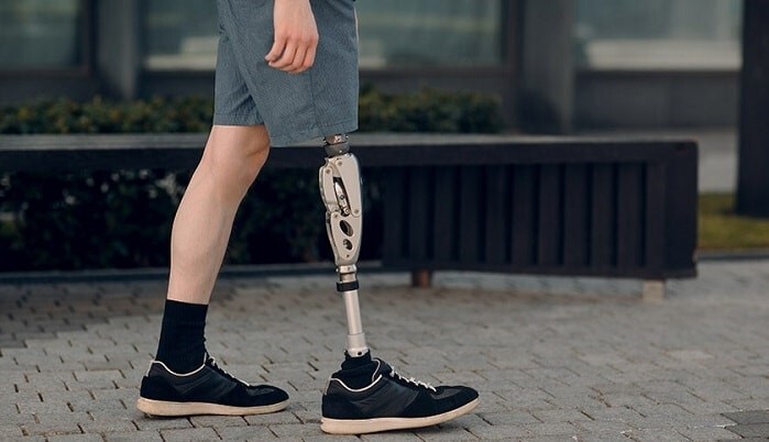 پروتز پا: انواع پای مصنوعی و نحوه سفارش پروتز پا: انواع پای مصنوعی و نحوه سفارش