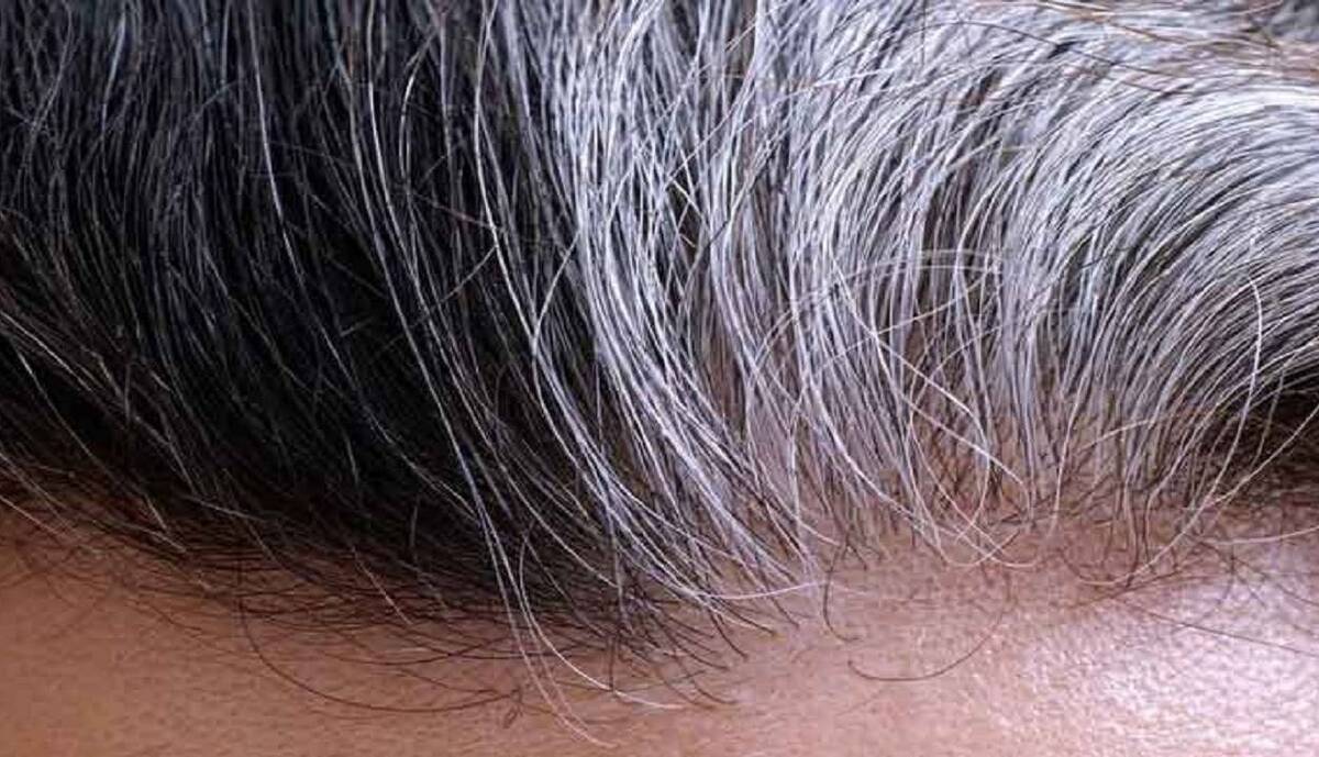 چه کار کنیم بعد از ۳۰ سالگی هم موهای پرپشت داشته باشیم؟