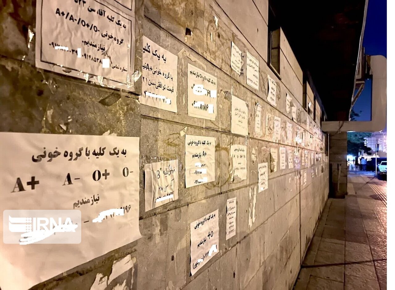 عضو بدن شما را خریداریم! / فروش دلاری کلیه با سفر ایرانی ها به ترکیه و عراق  عضو بدن شما را خریداریم! / فروش دلاری کلیه با سفر ایرانی ها به ترکیه و عراق