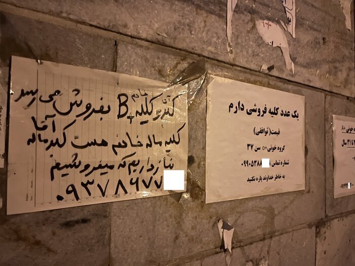 عضو بدن شما را خریداریم! / فروش دلاری کلیه با سفر ایرانی ها به ترکیه و عراق  عضو بدن شما را خریداریم! / فروش دلاری کلیه با سفر ایرانی ها به ترکیه و عراق