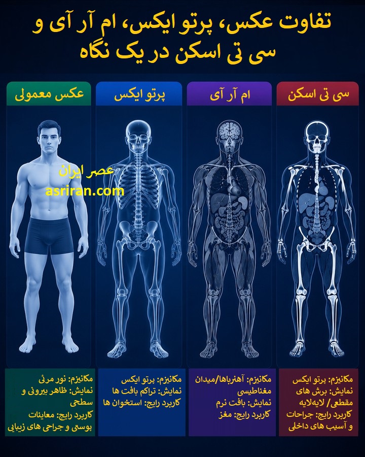 اینفوگرافیک مقایسه عکس معمولی (Photo)، پرتو ایکس (X-Ray)، ام آر آی (MRI) و سی تی اسکن (CT Scan) اینفوگرافیک مقایسه عکس معمولی (Photo)، پرتو ایکس (X-Ray)، ام آر آی (MRI) و سی تی اسکن (CT Scan)