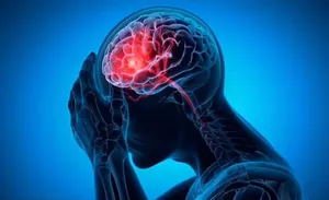 ارتباط میگرن با یک عارضه خطرناک در میانسالی