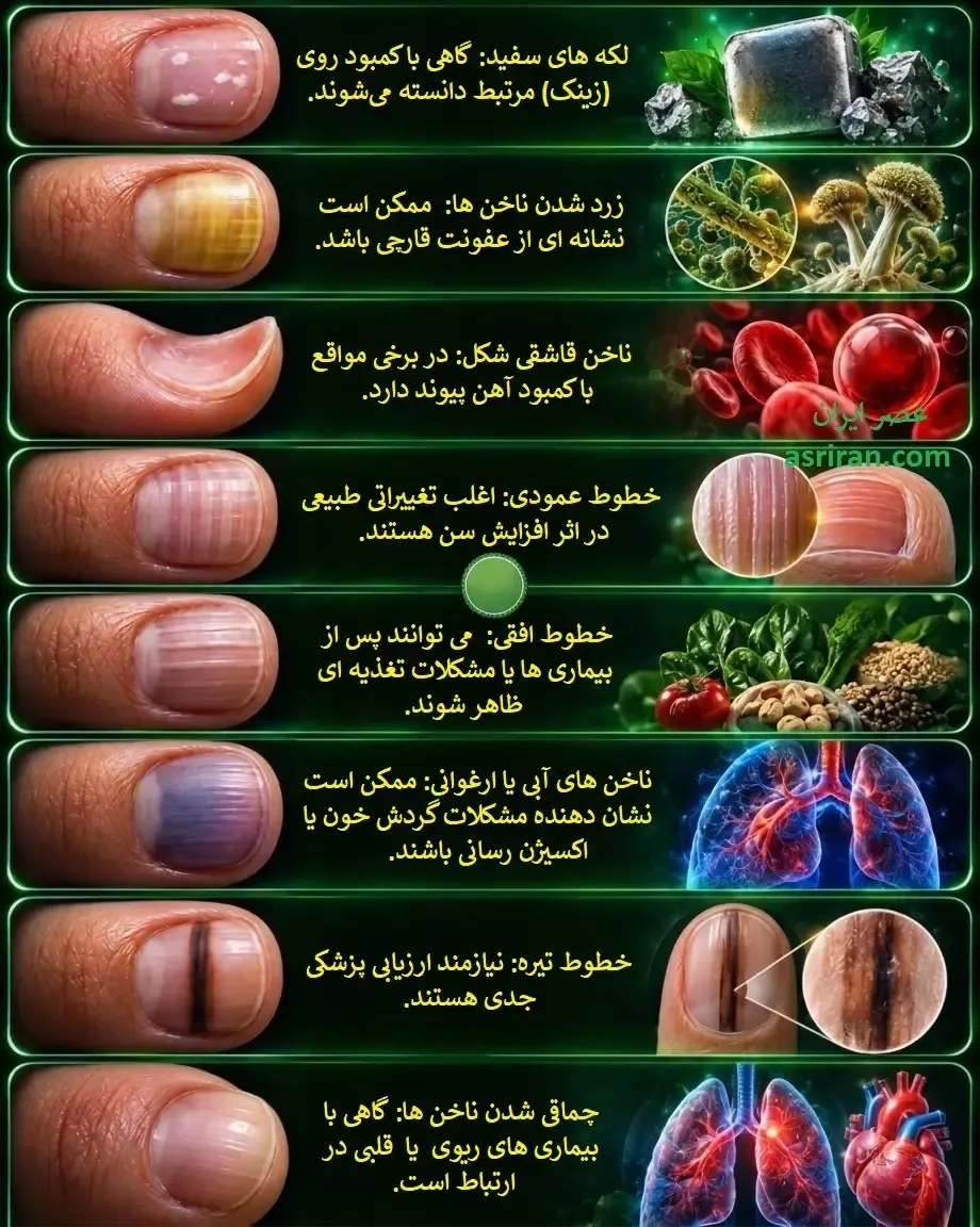 ناخن