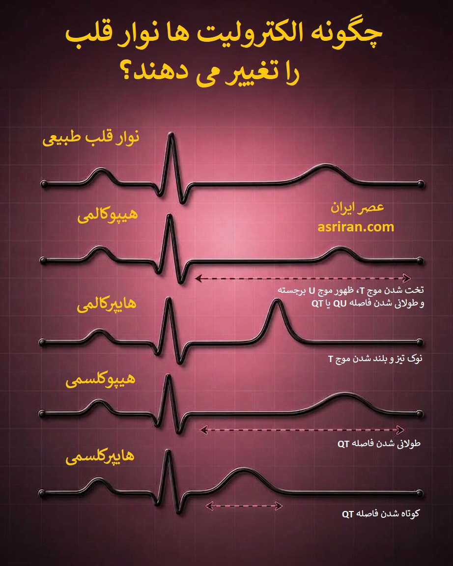 اینفوگرافیک تاثیر الکترولیت ها بر نوار قلب