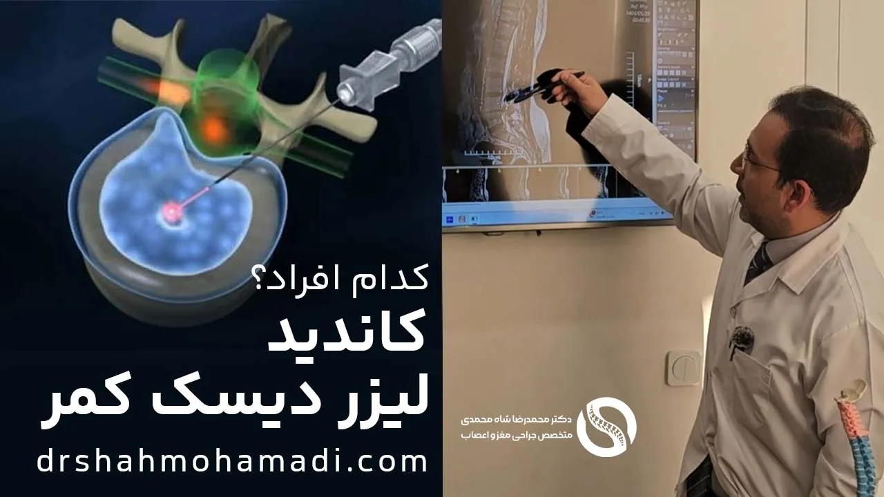 چه کسانی کاندید مناسب درمان دیسک کمر با لیزر هستند؟ توضیحات دکتر محمدرضا شاه محمدی جراح دیسک کمر