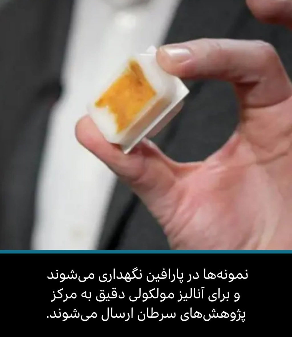 نمونهها برای ماندگاری در پارافین نگهداری میشوند نمونهها برای ماندگاری در پارافین نگهداری میشوند