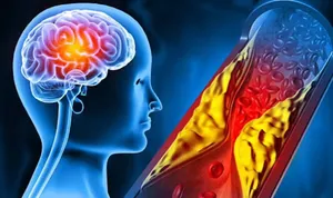 این لبخند بوی سکته می‌دهد
