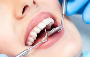 سلامت دهان ایرانیان؛ ۸۴.۳ درصد کودکان نیازمند درمان دندانپزشکی‌اند