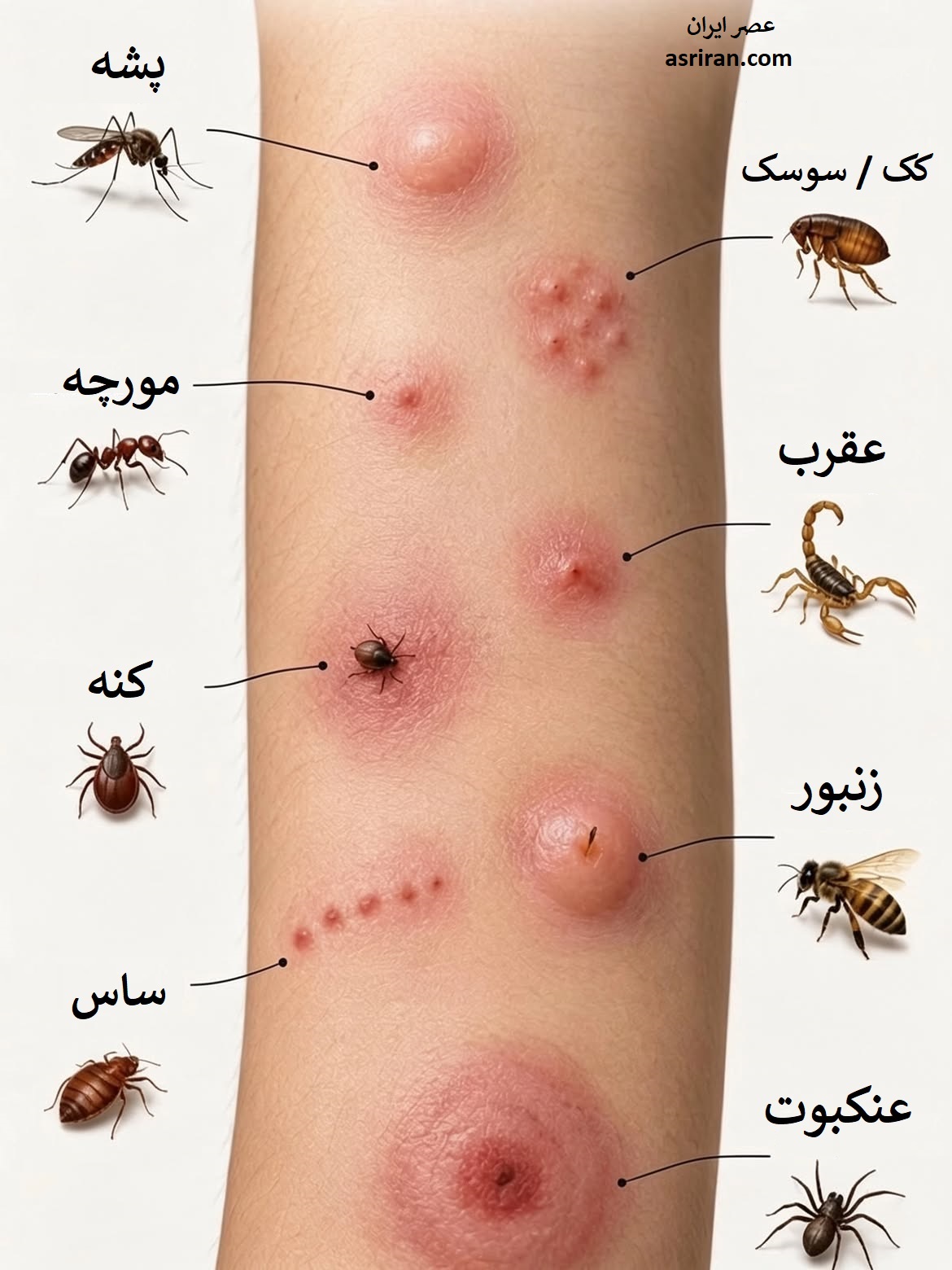 اینفوگرافیک راهنمای سریع و کاربردی تشخیص رایج ترین گزیدگی های حشرات بر اساس شکل ظاهری آن ها