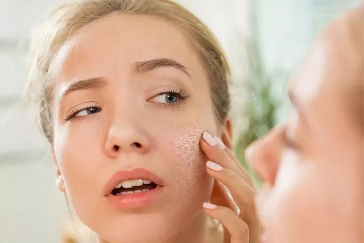 علائم خشکی پوست صورت