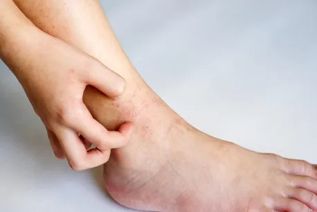 خارش قوزک پا؛ علت چیست
